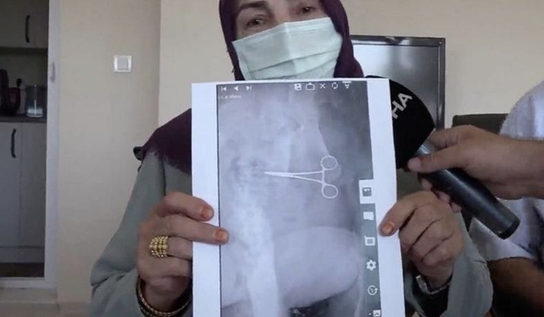 Habis Operasi, Gunting Bedah Tertinggal di Dalam Perut Perempuan Ini