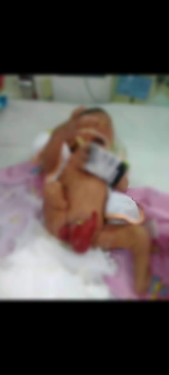 Heboh Bayi Lahir dengan Kelainan Kelamin di Inhu