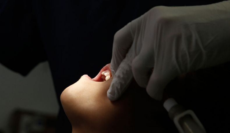 Bikin Ngilu, Dokter Gadungan Ini Cabut 13 Gigi Seorang Pasien