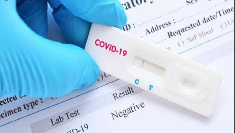 Baru, Alat Tes PCR Kumur ini Buatan Dalam Negeri