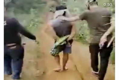 Pembakar Gadis Cantik Diringkus di Hutan, Mukanya Ikut Terbakar