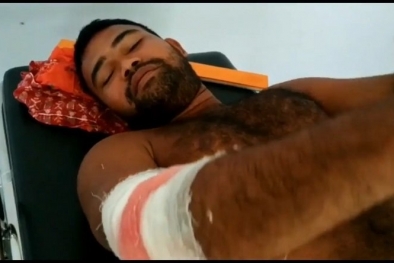 Gajah Liar Mengamuk, Mahout Kena Sabet Gading