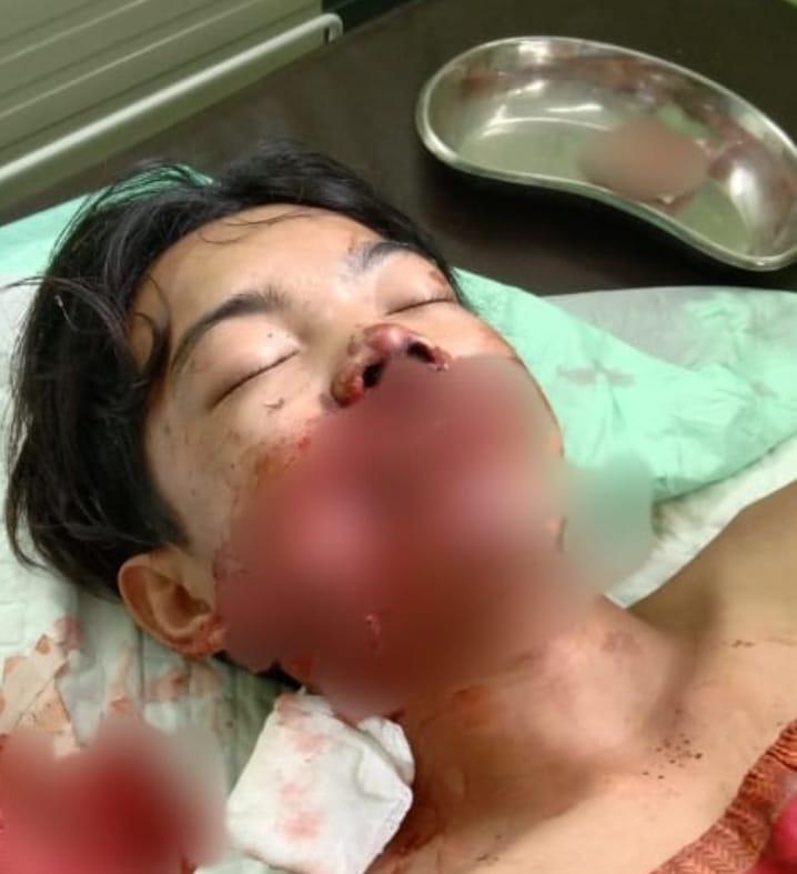 Lajang ini Diserang Beruang Saat Mencari Jernang