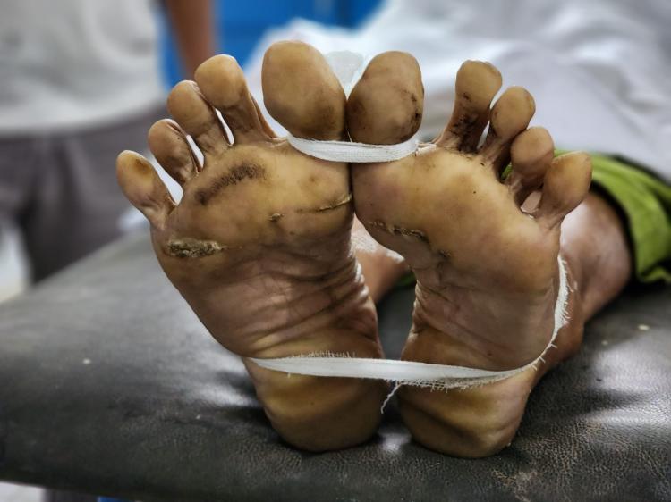 Egreknya Nyenggol Kabel Listrik, Pekerja Perusahaan Sawit Tewas