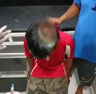 Dicakar Harimau, Kepala Pekerja HTI di Teluk Meranti Pelalawan Robek hingga 20 Jahitan